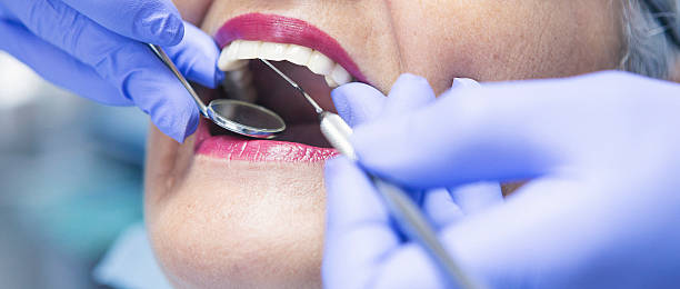 Best Emergency Dentist for Lost Fillings or Crowns in Beaver, PA